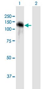 CDH16 Antibody in Western Blot (WB)