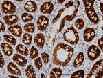 CDH17 Antibody in Immunohistochemistry (Paraffin) (IHC (P))