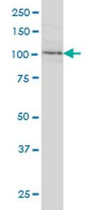 CDH18 Antibody in Western Blot (WB)