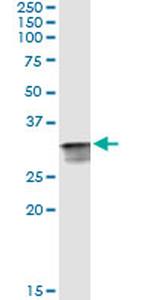 CDK2 Antibody in Immunoprecipitation (IP)