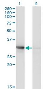 CDK2 Antibody in Western Blot (WB)