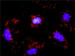 CDK4 Antibody in Proximity Ligation Assay (PLA) (PLA)