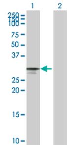CDK4 Antibody in Western Blot (WB)