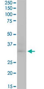 CDK4 Antibody in Western Blot (WB)