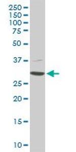 CDK4 Antibody in Western Blot (WB)