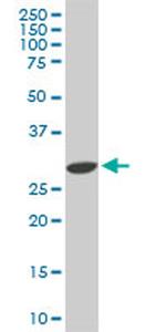 CDK4 Antibody in Western Blot (WB)
