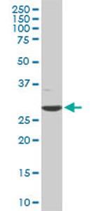CDK4 Antibody in Western Blot (WB)