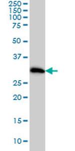 CDK4 Antibody in Western Blot (WB)