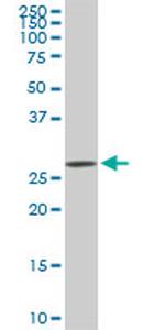 CDK4 Antibody in Western Blot (WB)