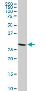 CDK4 Antibody in Western Blot (WB)