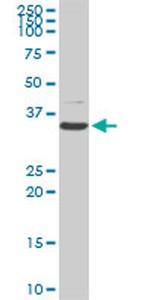 CDK4 Antibody in Western Blot (WB)