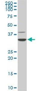 CDK4 Antibody in Western Blot (WB)