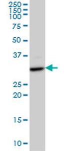 CDK4 Antibody in Western Blot (WB)