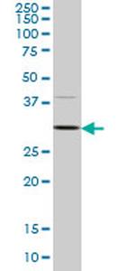 CDK4 Antibody in Western Blot (WB)