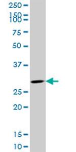 CDK4 Antibody in Western Blot (WB)