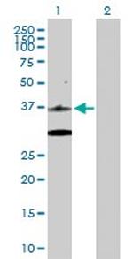 CDK6 Antibody in Western Blot (WB)