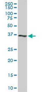 CDK6 Monoclonal Antibody (8H4)