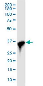 CDK6 Monoclonal Antibody (8H4)