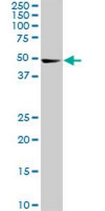 CDK8 Monoclonal Antibody (6H5)