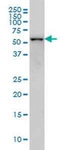CDK8 Monoclonal Antibody (6E5)