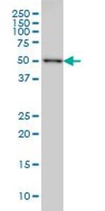 CDK8 Monoclonal Antibody (5H4)