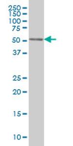 CDK8 Monoclonal Antibody (2E6)