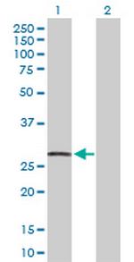 CDKN1A Antibody in Western Blot (WB)