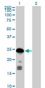CDKN1B Antibody in Western Blot (WB)