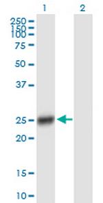 CDKN1B Antibody in Western Blot (WB)