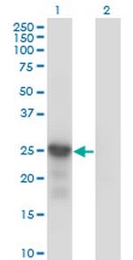 CDKN1B Antibody in Western Blot (WB)