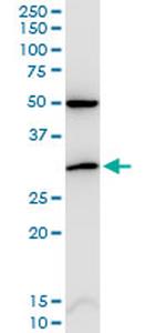CDKN1B Antibody in Western Blot (WB)