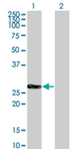 CDKN1B Antibody in Western Blot (WB)