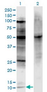 CDKN2A Monoclonal Antibody (3F3)