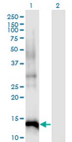 CDKN2B Monoclonal Antibody (8C4)