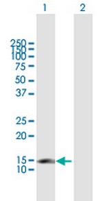 CDKN2C Polyclonal Antibody, MaxPab™