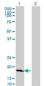 CDKN2D Antibody in Western Blot (WB)