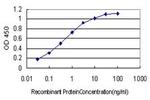 CDR2 Antibody in ELISA (ELISA)