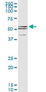 CDR2 Antibody in Western Blot (WB)