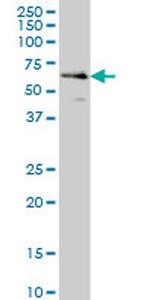 CDR2 Antibody in Western Blot (WB)
