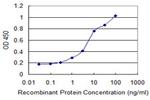 CDR2 Antibody in ELISA (ELISA)