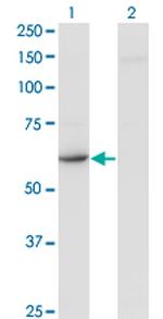 CDR2 Antibody in Western Blot (WB)