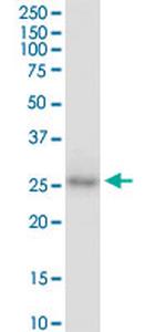 CDX1 Antibody in Western Blot (WB)