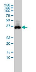 CDX2 Antibody in Western Blot (WB)