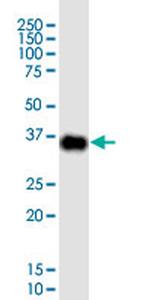 CDX2 Monoclonal Antibody (3A12)