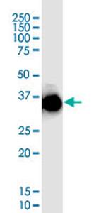 CDX2 Monoclonal Antibody (3L10)