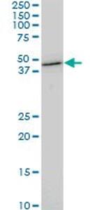 CDX4 Antibody in Western Blot (WB)