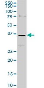 CDX4 Antibody in Western Blot (WB)
