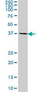 CDX4 Antibody in Western Blot (WB)