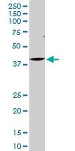 CDX4 Antibody in Western Blot (WB)