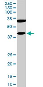 CDX4 Antibody in Western Blot (WB)